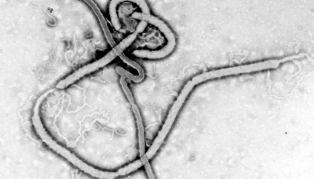 Ebola-viruset.