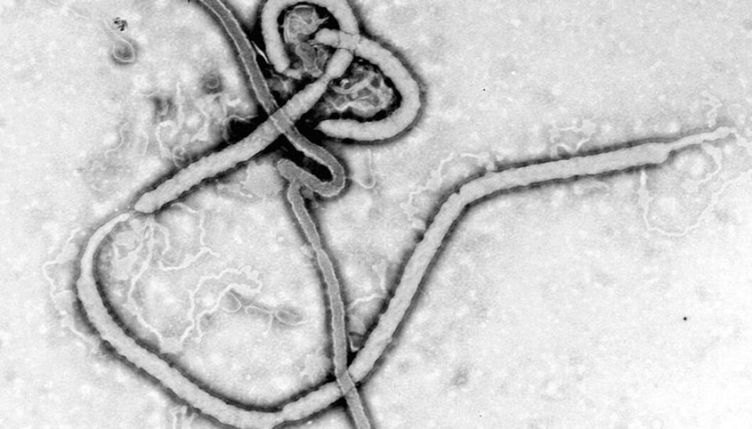 Ebola-viruset. Ebola-viruset.